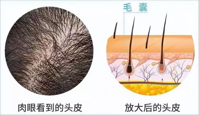 春天头发可以长得更快吗？