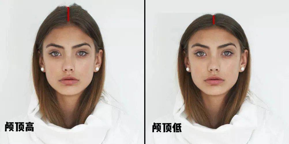 秃星人如何秒变发量王者？七种方法总有一个适合你！你学会了吗